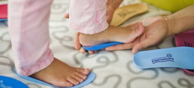 Solitions with deformation of the foot of the foot in children