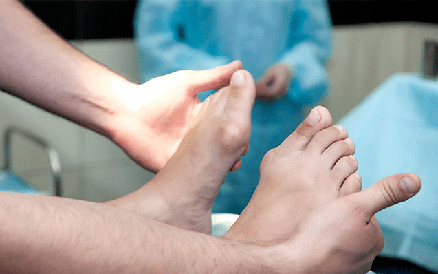 Foot deformation valgus